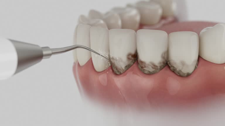 Trusted Dental Crowns And Bridges service in Woodward, IA - Dentist Open Now